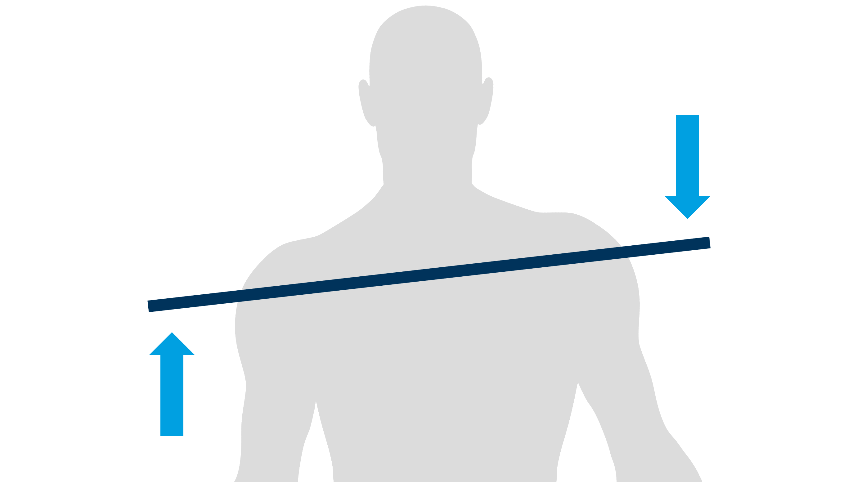 Die Grafik zeigt die Silhouette eines Mannes. Seine Schulter sind auf die linke Seite geneigt. Ein Balken ist über die Schultern gelegt und verdeutlicht die geneigte Position.